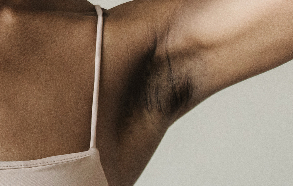 armpit with post-inflammatory hyperpigmentation