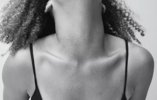 Chest Acne: Chest and Neck in BW