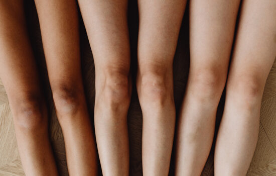 women showcasing their knees without skin brightening ingredients that will minimize dark spots