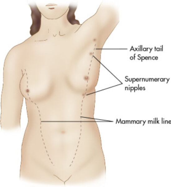 armpit-lumps-pregnancy-tail-of-spence
