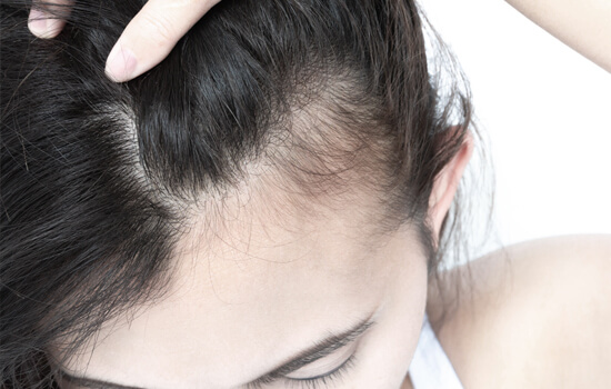 scalp closeup - scalp pimple